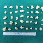 DİZİNDEN ÇIKAN EKLEM FARELERİ ŞAŞIRTTI