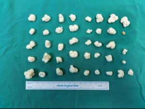 DİZİNDEN ÇIKAN EKLEM FARELERİ ŞAŞIRTTI