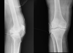 DİZİNDEN ÇIKAN EKLEM FARELERİ ŞAŞIRTTI