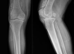 DİZİNDEN ÇIKAN EKLEM FARELERİ ŞAŞIRTTI