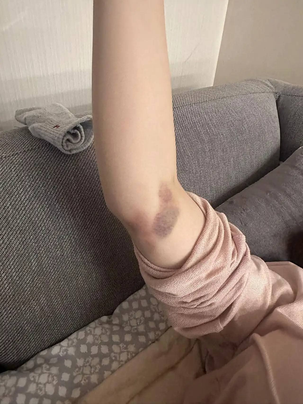 YALOVA’DA ÖZEL HASTANEDE ORTOPEDİ SKANDALI İDDİASI: